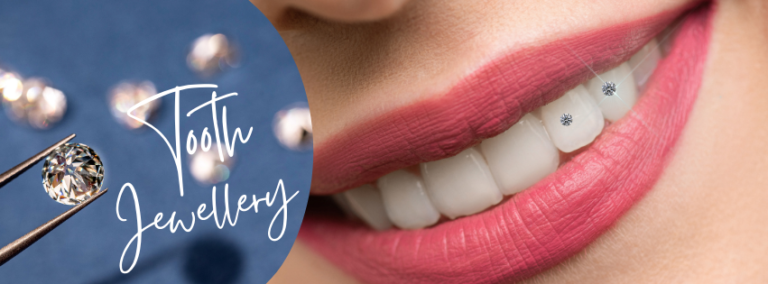 Shine Bright with Tooth Jewelry: Dentist vs. DIY, Tooth Gap Trends, and Common FAQs
