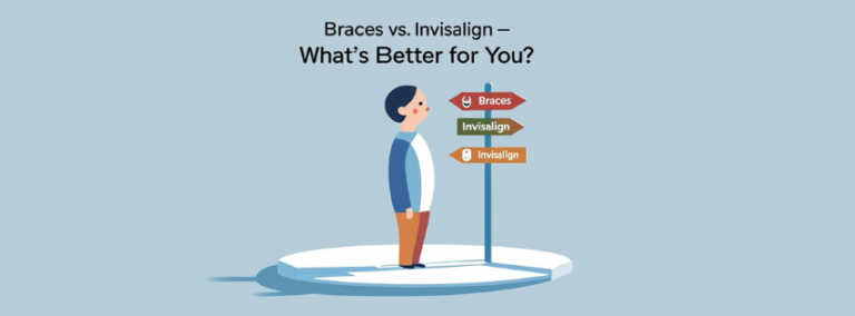 Braces vs invisalign:What is better?